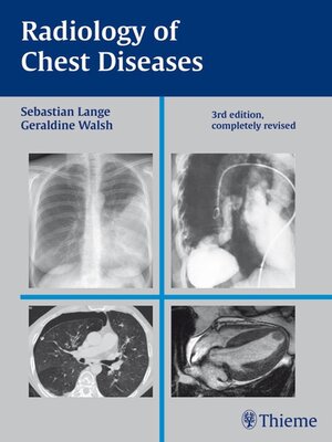 cover image of Radiology of Chest Diseases